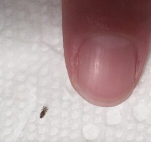 Read more about the article Title: How to Get Rid of Head Lice and Keep Them from Coming Back
