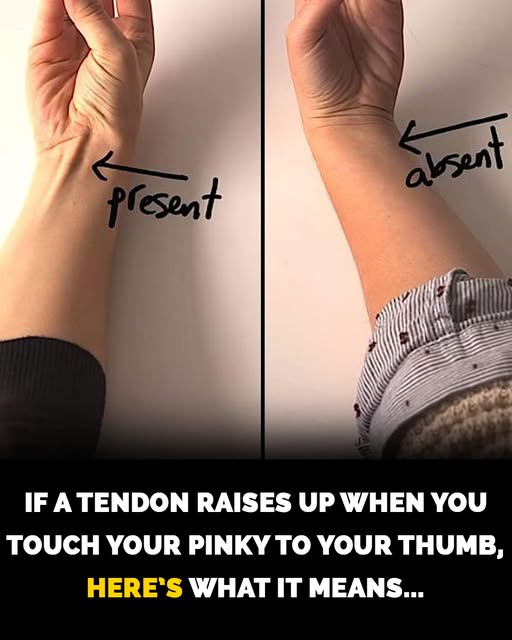 You are currently viewing Have You Lost This Tendon in Your Arm Due to Evolution?