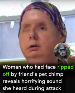 Read more about the article Woman Reveals Shocking Details of Attack by Friend’s Pet Chimp, Leaving Her Face Ripped Off