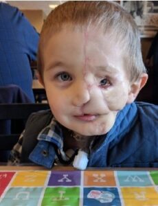 Read more about the article 5-Year-Old Boy Survives Savage Dog Attack, Only to Be Called a ‘Monster’ in Public