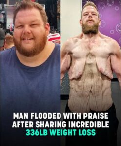 Read more about the article Man Praised for 360lb Weight Loss Journey: An Inspirational Transformation