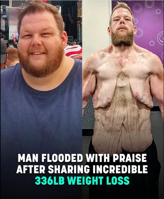 You are currently viewing Man Praised for 360lb Weight Loss Journey: An Inspirational Transformation
