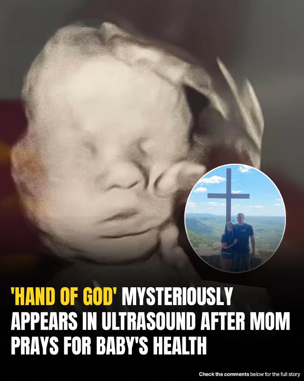 You are currently viewing Mom Spots “God’s Hand” Cradling Baby’s Head in Ultrasound: A Miraculous Moment