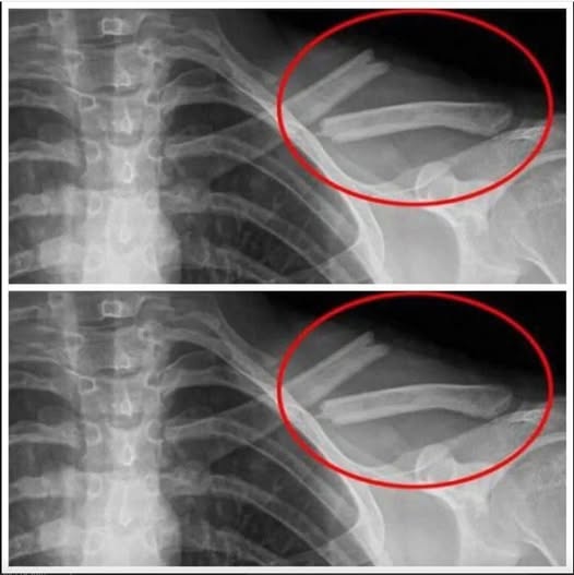 Read more about the article 8 Things That Happen to Your Body When You Stop Drinking Diet Soda