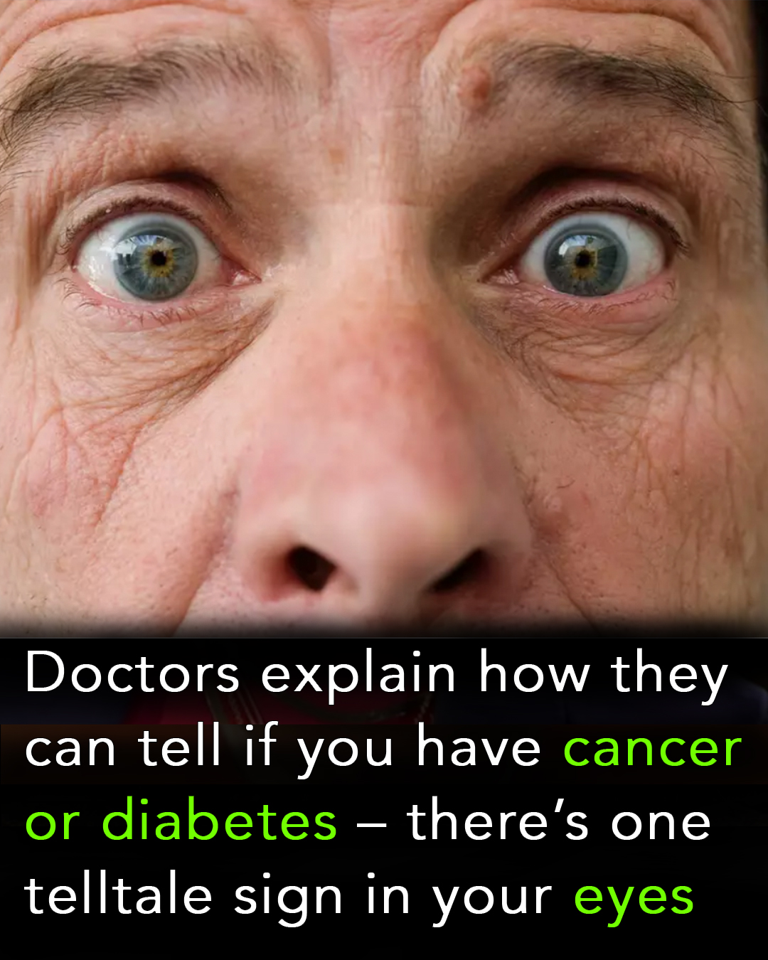 You are currently viewing “Doctors Explain How They Can Detect Cancer or Diabetes Through Your Eyes”
