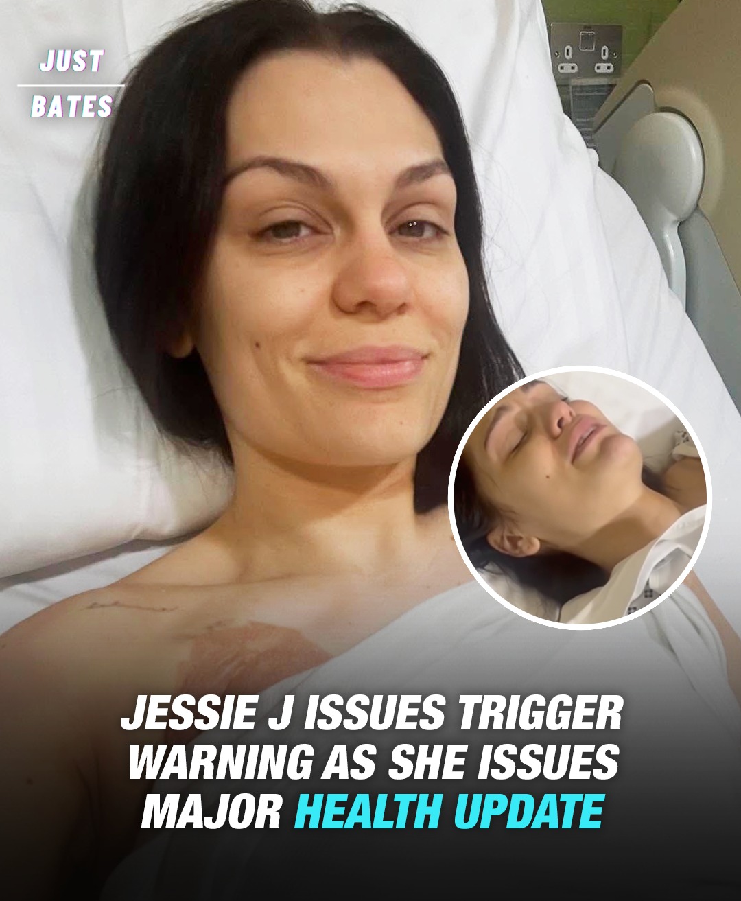 Read more about the article Jessie J Shares Health Update After Cancer Surgery