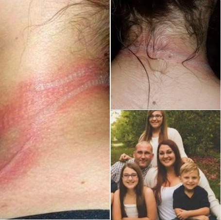 Read more about the article 13-Year-Old Girl Suffers Horrific Burns After Using Phone While Charging