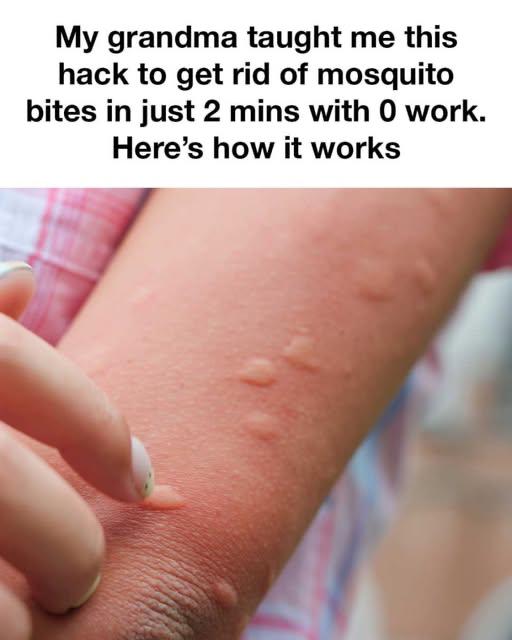 Read more about the article Doctors Warn Against Viral Hot Spoon Mosquito Hack: Safer Alternatives You Should Try