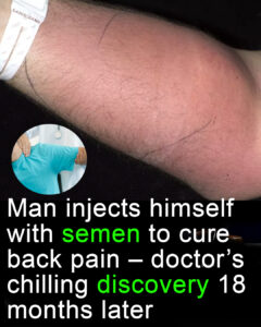 Read more about the article Doctor Warns Against Dangerous DIY Treatments After Man Injects Semen to Cure Back Pain