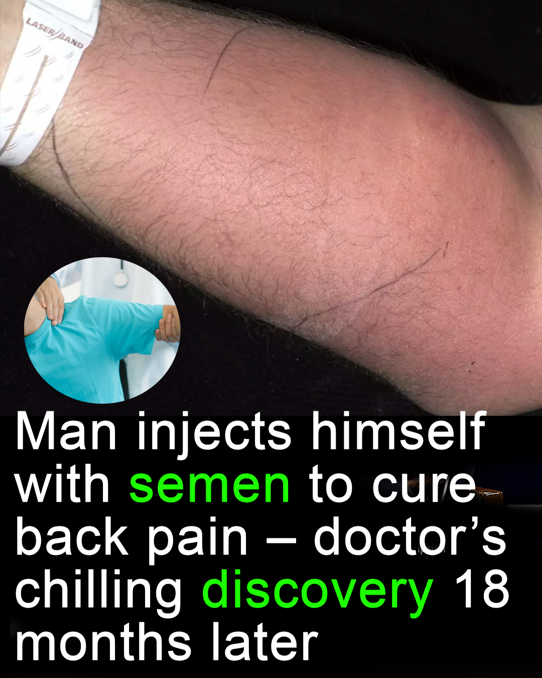 Read more about the article Doctor Warns Against Dangerous DIY Treatments After Man Injects Semen to Cure Back Pain