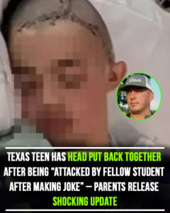 Read more about the article Texas Teen’s Head Reconstructed After Violent Attack by Fellow Student Over a Joke