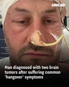 Read more about the article Man Diagnosed with Two Brain Tumors After Dismissing Symptoms as ‘Hangover’