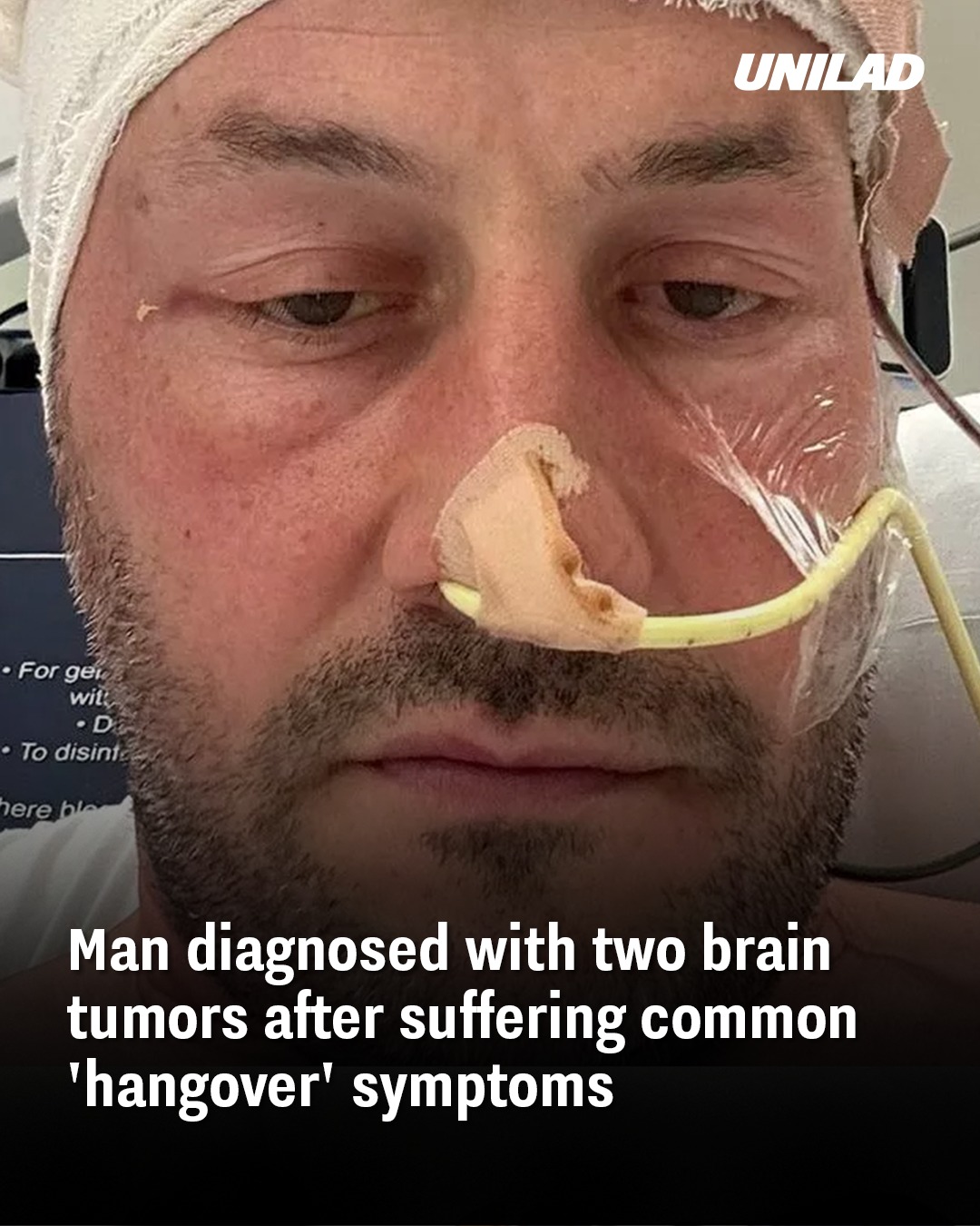 You are currently viewing Man Diagnosed with Two Brain Tumors After Dismissing Symptoms as ‘Hangover’