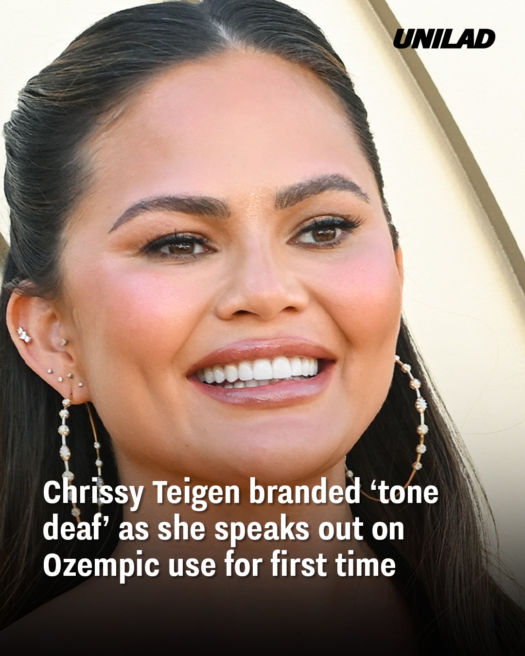 You are currently viewing Chrissy Teigen Faces Backlash for Ozempic Comments Amid Candid Interview on Weight Loss Struggles