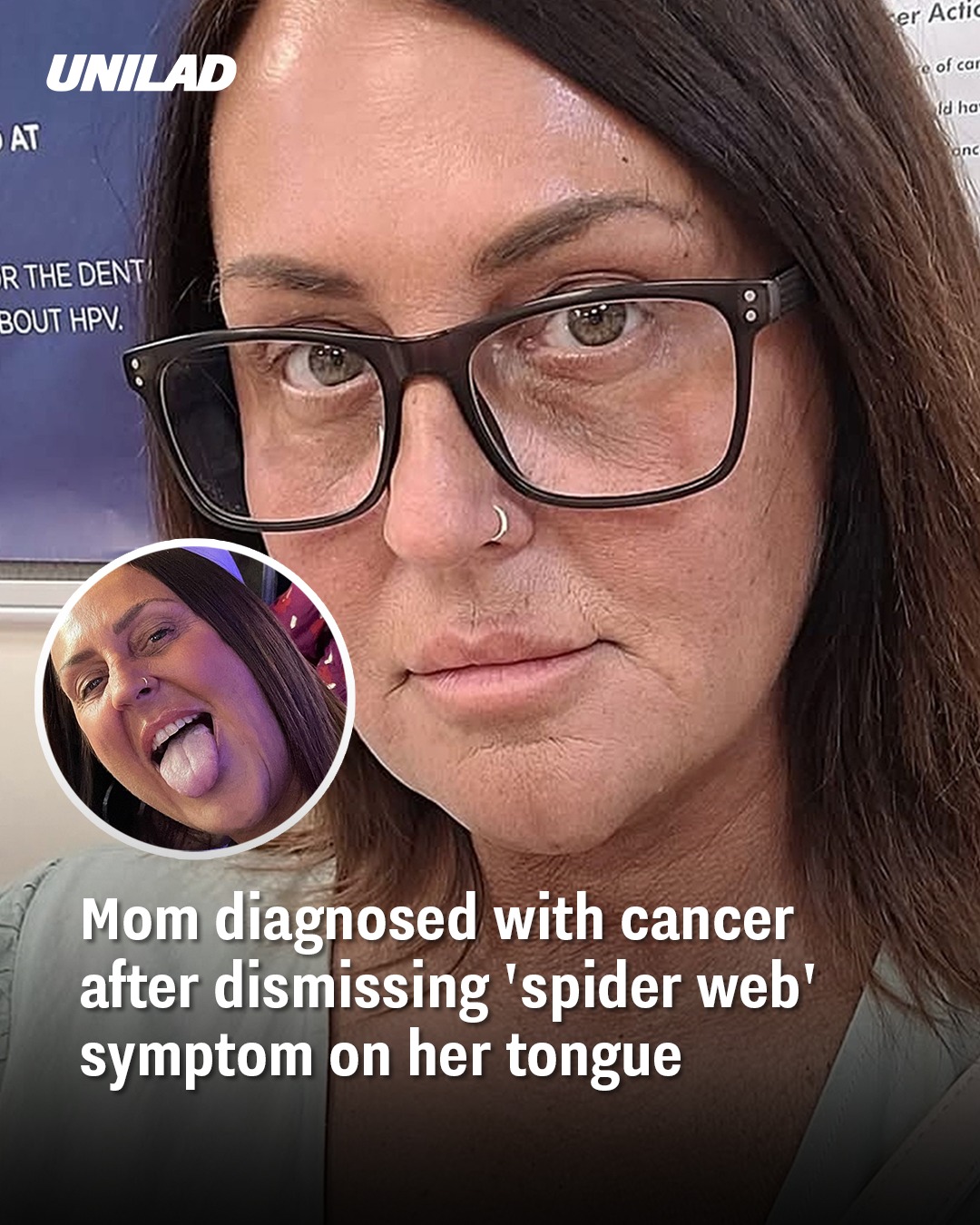 Read more about the article Mother Diagnosed with Cancer After Years of Dismissed ‘Spider Web’ Symptom on Her Tongue