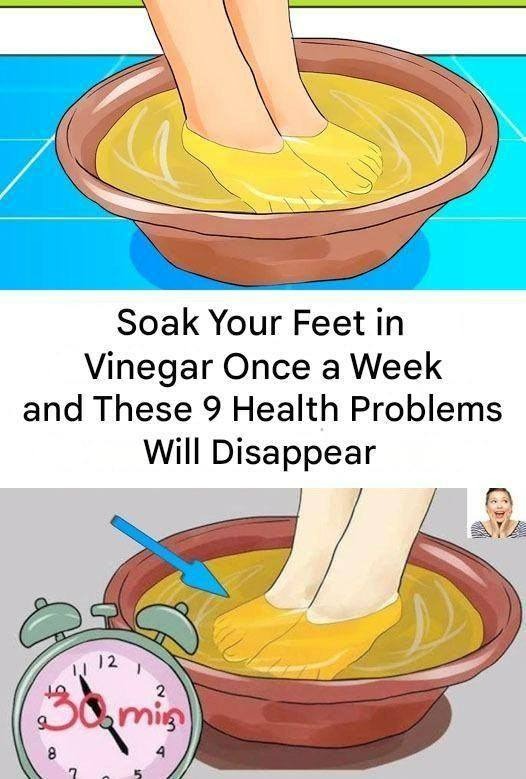 Read more about the article Apple Cider Vinegar Foot Soak: Benefits, Risks & Science-Backed Guide
