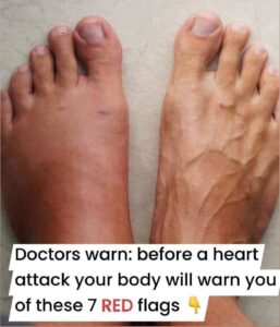 Read more about the article Early Warning Signs of Heart Trouble: What Your Body Might Be Trying to Tell You ❤️