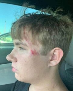 Read more about the article Heroic Teenager Saves Toddler From Drowning: Tanner’s Split-Second Action