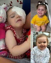 Read more about the article An Incredible Survival Story: How a Baby Beat Cancer and Inspired the World