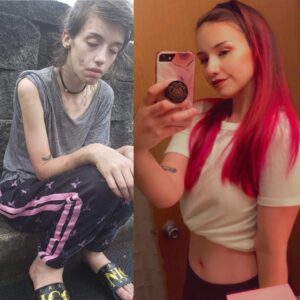 Read more about the article An Incredible Recovery: How One Woman Fought Back From the Brink