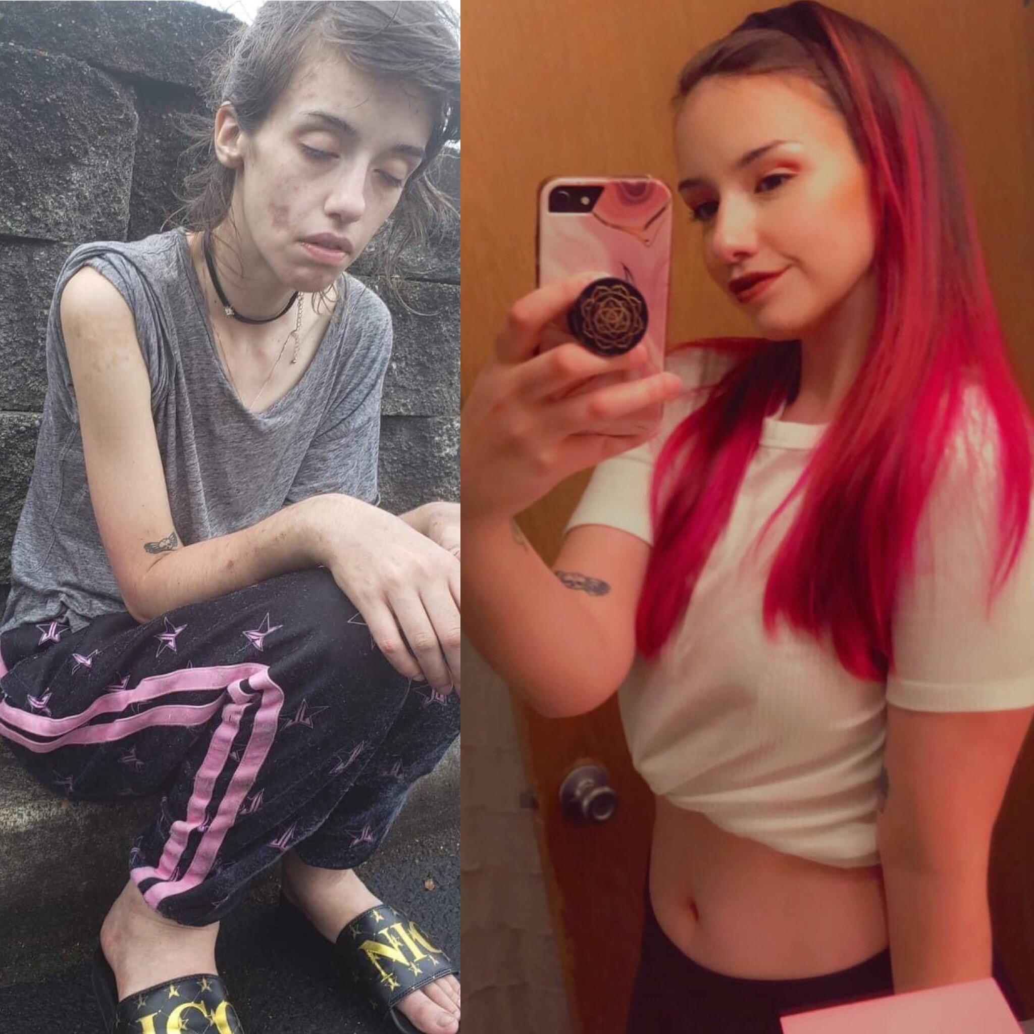 You are currently viewing An Incredible Recovery: How One Woman Fought Back From the Brink