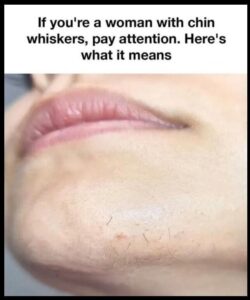 Read more about the article The Science of Chin Hair Growth: Hormones, Health, and Solutions